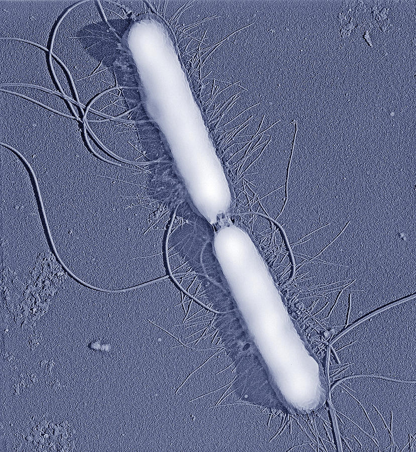 Proteus Vulgaris Photograph - Proteus Vulgaris Bacteria, Sem #3 by Thomas Deerinck, Ncmir