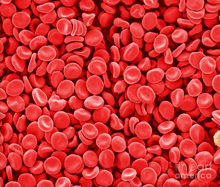 Red Blood Cells, Sem Photograph by Scimat