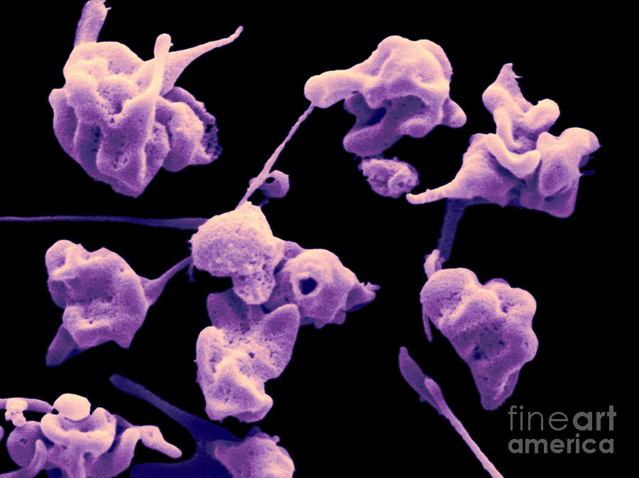 Sem Of Platelets #3 Photograph by Scimat