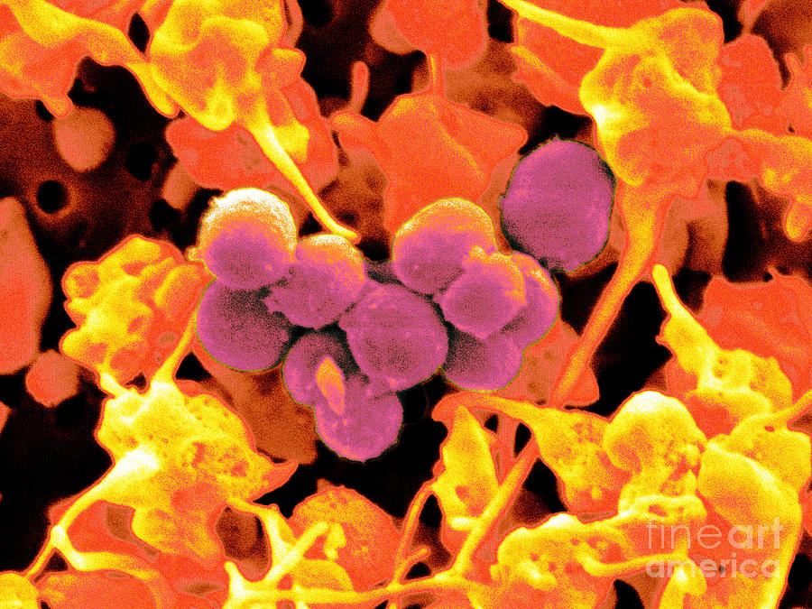 Staphylococcus Epidermidis Bacteria #3 Photograph by Scimat