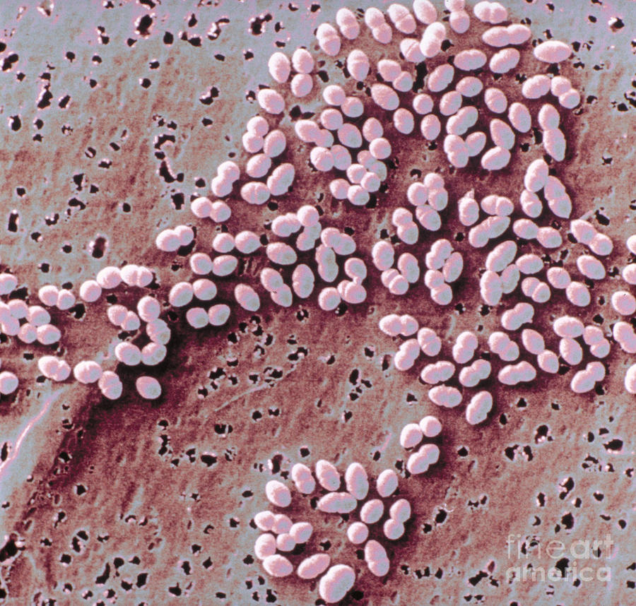 Streptococcus Faecalis Photograph - Streptococcus Faecalis #3 by Scimat