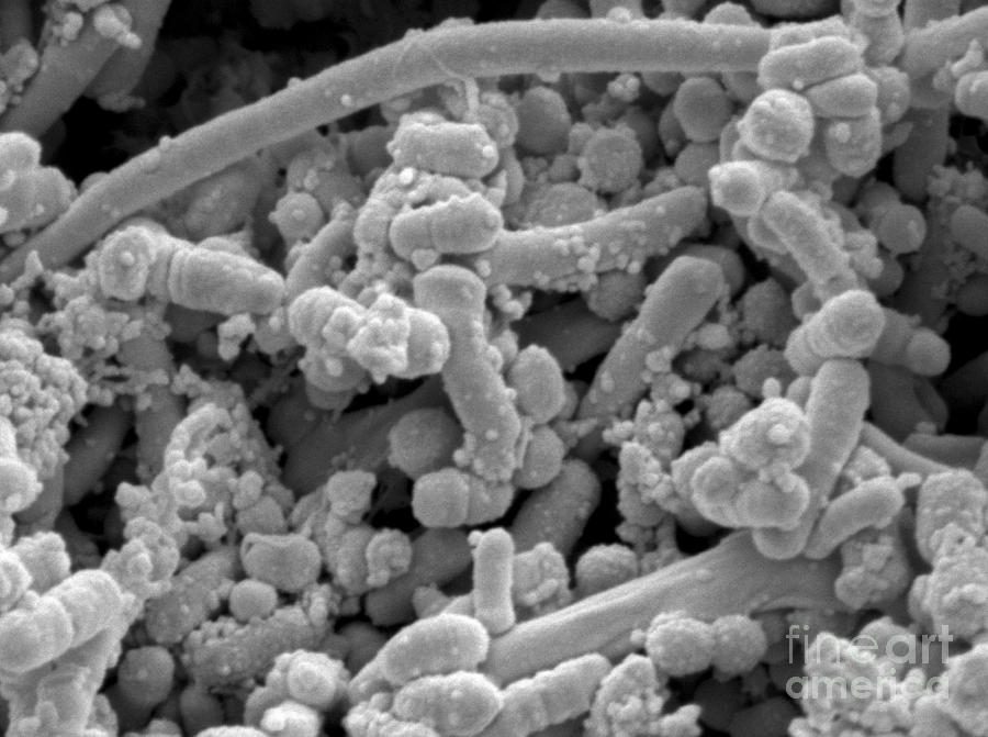 Streptococcus Pyogenes #3 Photograph by Scimat