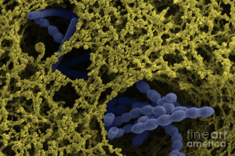 Streptococcus Thermophilus #3 Photograph by Scimat