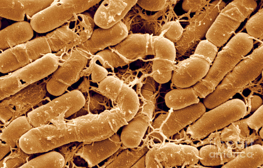 Bacillus Thuringiensis Bacteria #4 Photograph by Scimat
