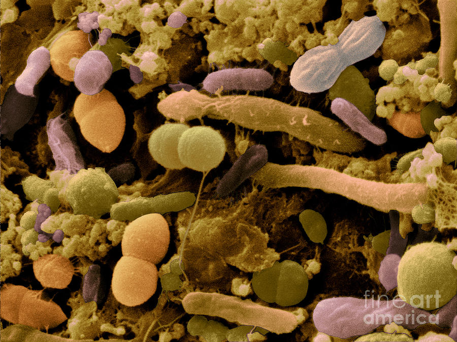 Bacteria In Cat Feces #4 Photograph by Scimat
