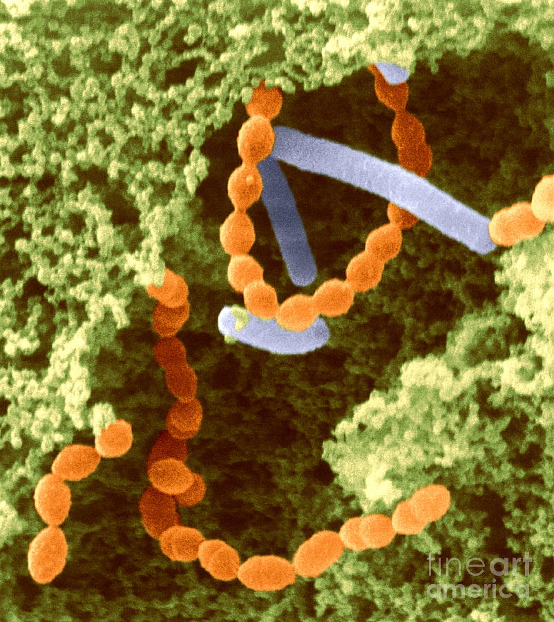 Bacillus Thuringiensis Bacteria #4 Photograph by Scimat - Fine Art