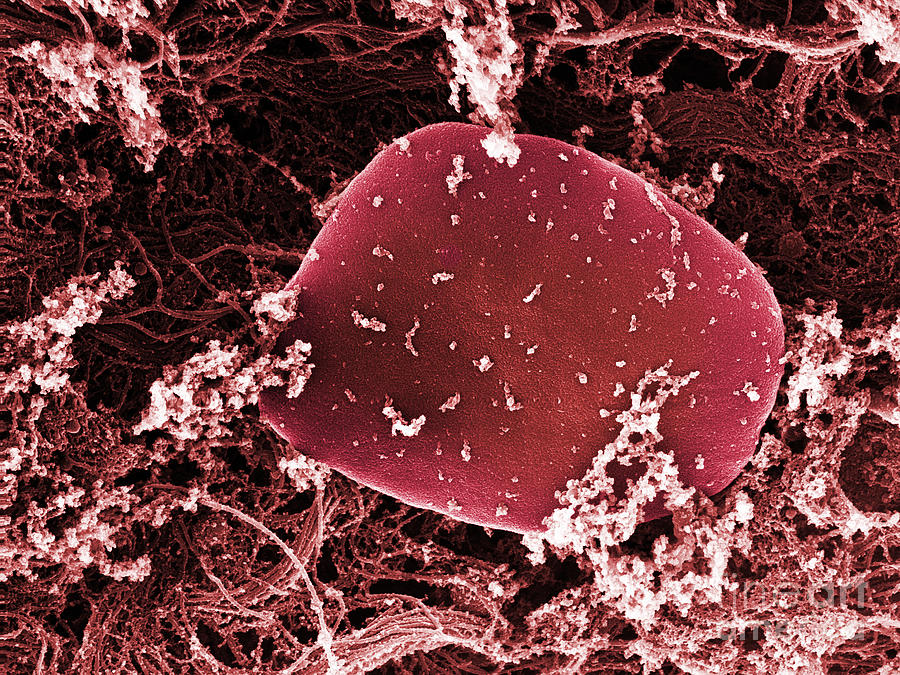Blood Platelets, Sem #4 Photograph by Ted Kinsman