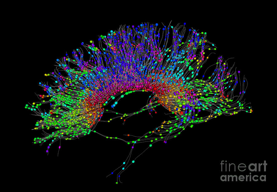Brain, Fiber Tractography Image #4 Photograph by Scott Camazine