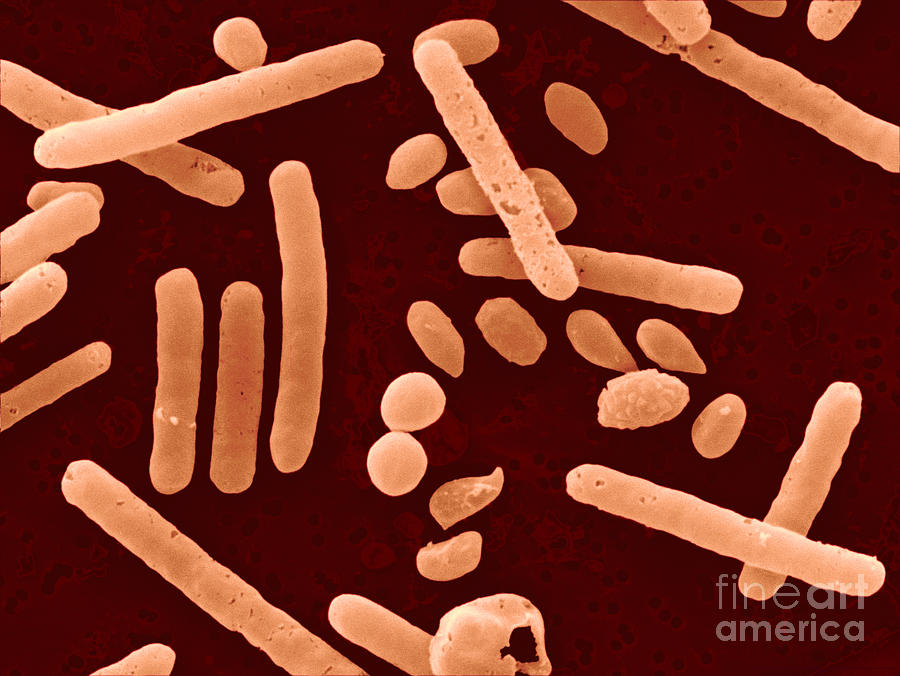 Clostridium Difficile Bacteria #4 Photograph by Scimat