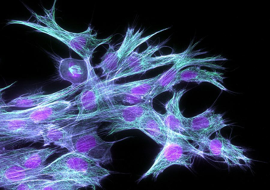Biological Photograph - Fibroblast Cells, Fluorescent Micrograph #4 by Dr Torsten Wittmann