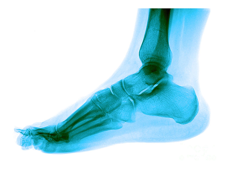 Foot #4 Photograph by Medical Body Scans