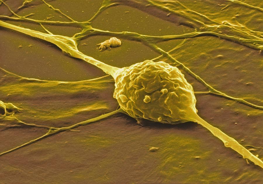 Granule Nerve Cell, Sem #4 Photograph by David Mccarthy