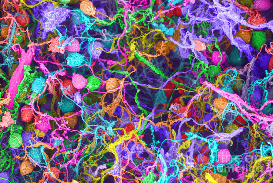 Human Brain Cells, Sem #4 Photograph by Ted Kinsman