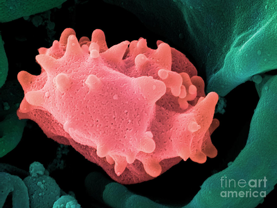 Human Lymphocyte Cell, Sem #4 Photograph by Ted Kinsman