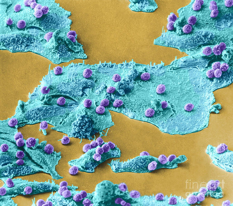 Immune Cells Attacking Cancer Cells, Sem #4 Photograph by Science Source