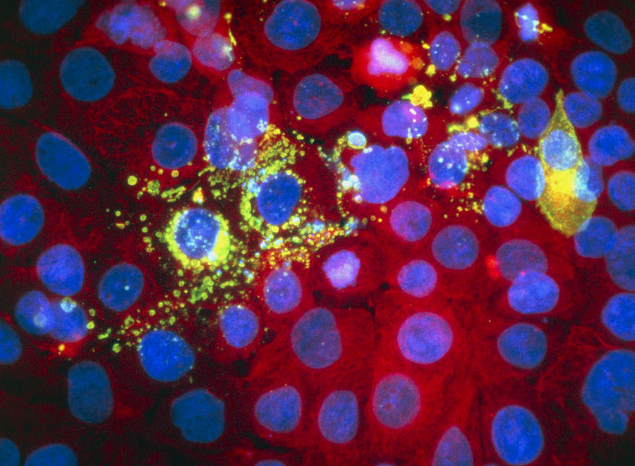 Apoptosis Photograph - Immunfluorescent Lm Of Cell Death (apoptosis) #4 by Nancy Kedershaimmunogen