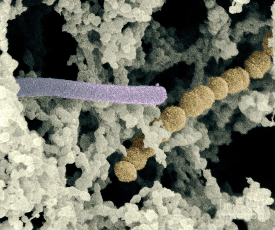 Lactic Acid Bacteria #4 Photograph by Scimat