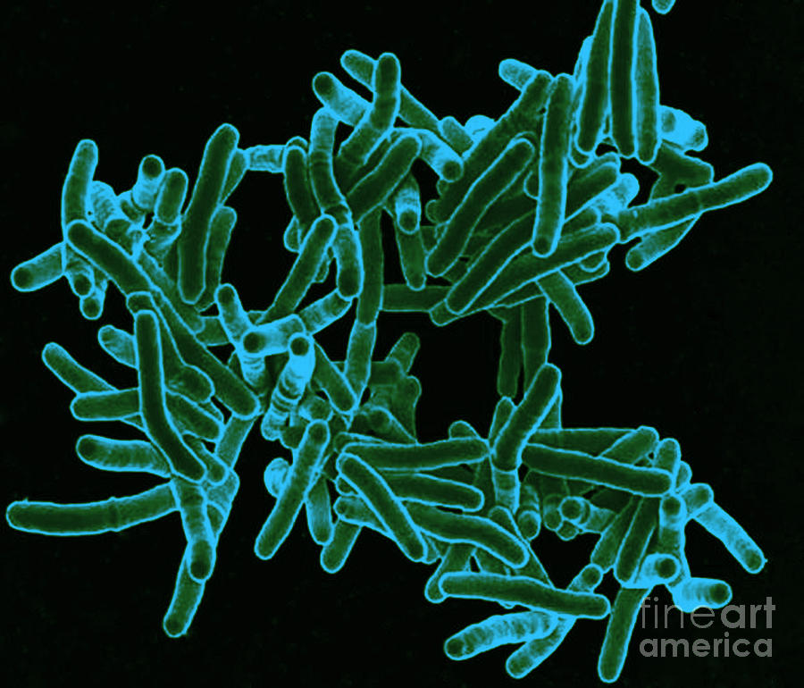 Mycobacterium Tuberculosis Bacteria, Sem #4 Photograph by Science Source