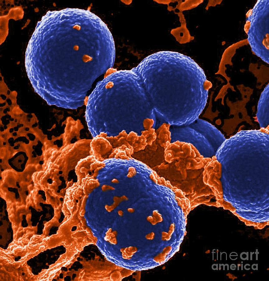 Neutrophil Ingesting Mrsa Bacteria, Sem #4 Photograph by Science Source