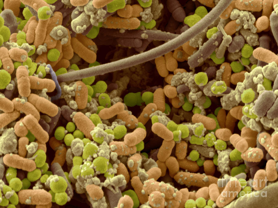 Streptococcus Pyogenes #4 Photograph by Scimat