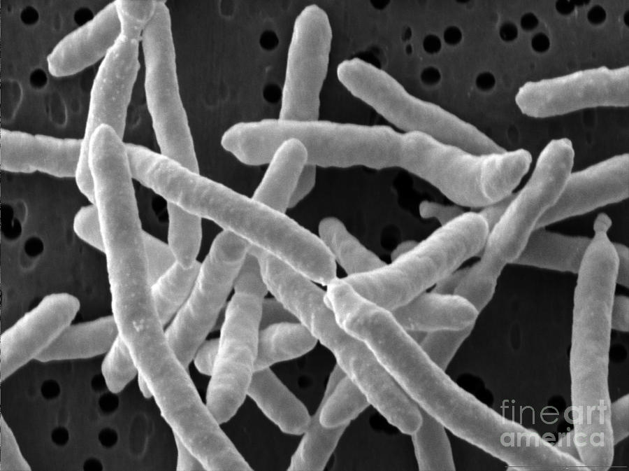 Yersinia Enterocolitica Bacteria Photograph by Scimat - Fine Art America