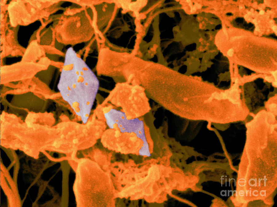 Bacillus Thuringiensis Bacteria #5 Photograph by Scimat