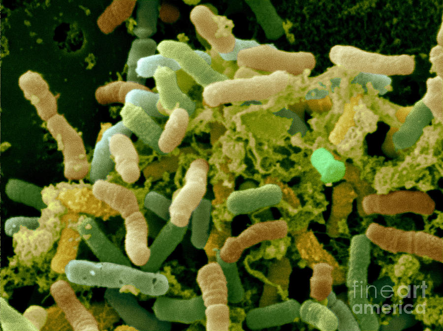 Bacterial Microflora In The Stool #5 Photograph by Scimat