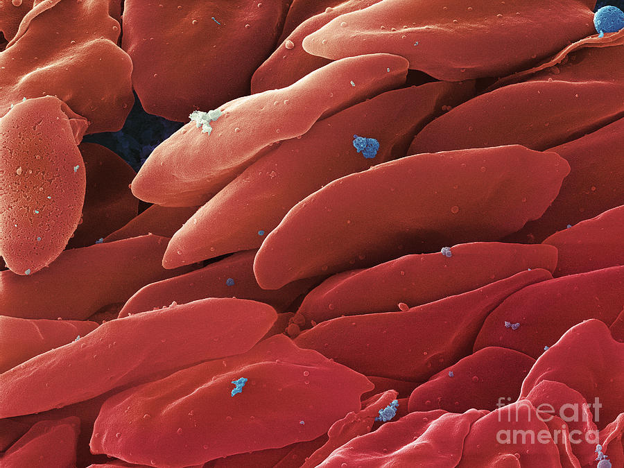 Blood Platelets, Sem #5 Photograph by Ted Kinsman