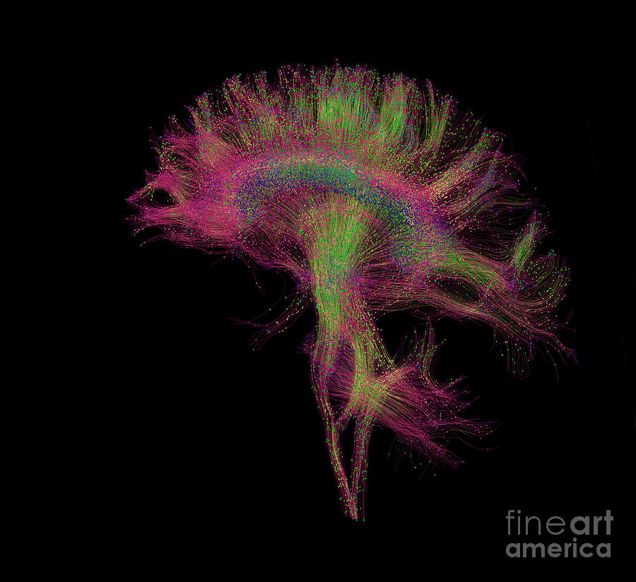 Brain, Fiber Tractography Image #5 Photograph by Scott Camazine