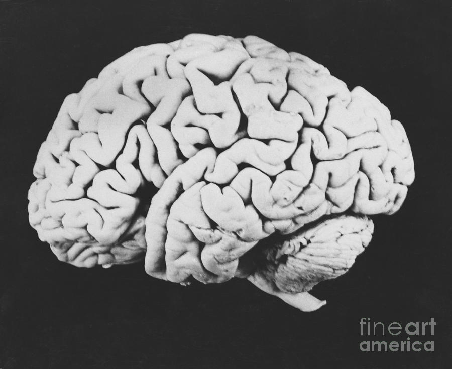 Brain Photograph - Human Brain #5 by Omikron
