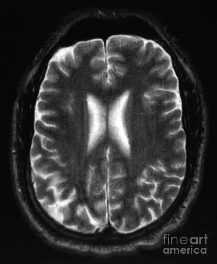 Human Brain #5 Photograph by Ted Kinsman