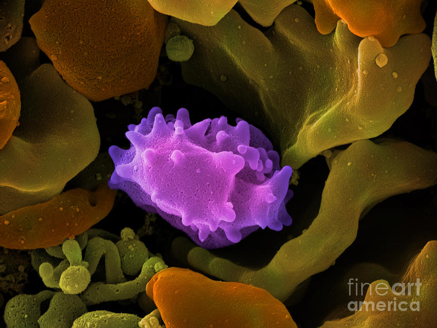 Human Lymphocyte Cell, Sem #5 Photograph by Ted Kinsman