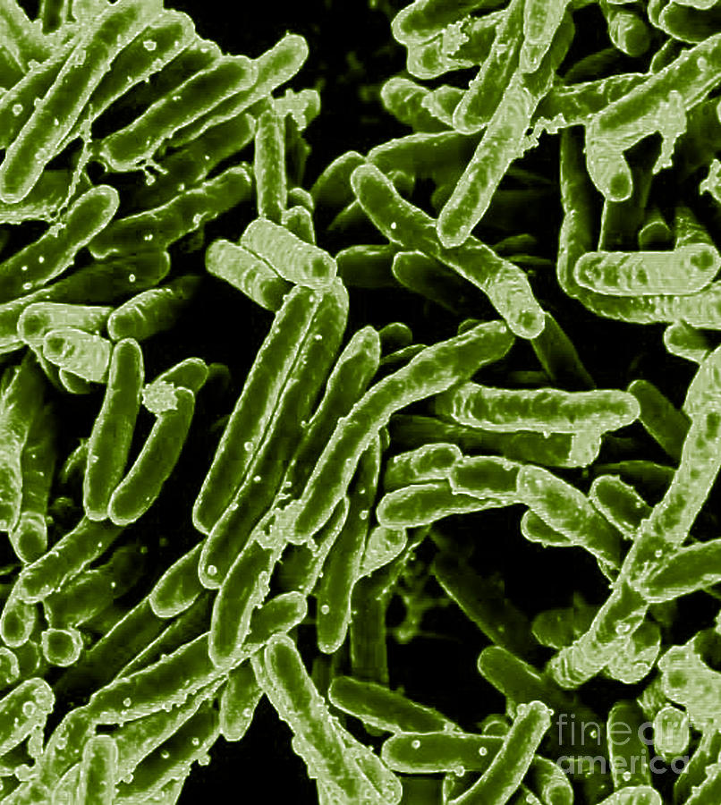 Mycobacterium Tuberculosis Bacteria, Sem #5 Photograph by Science Source