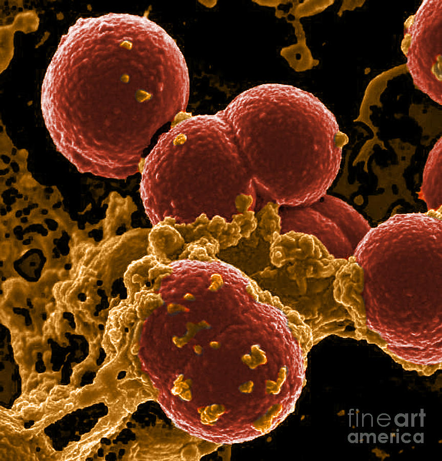 Neutrophil Ingesting Mrsa Bacteria, Sem #5 Photograph by Science Source