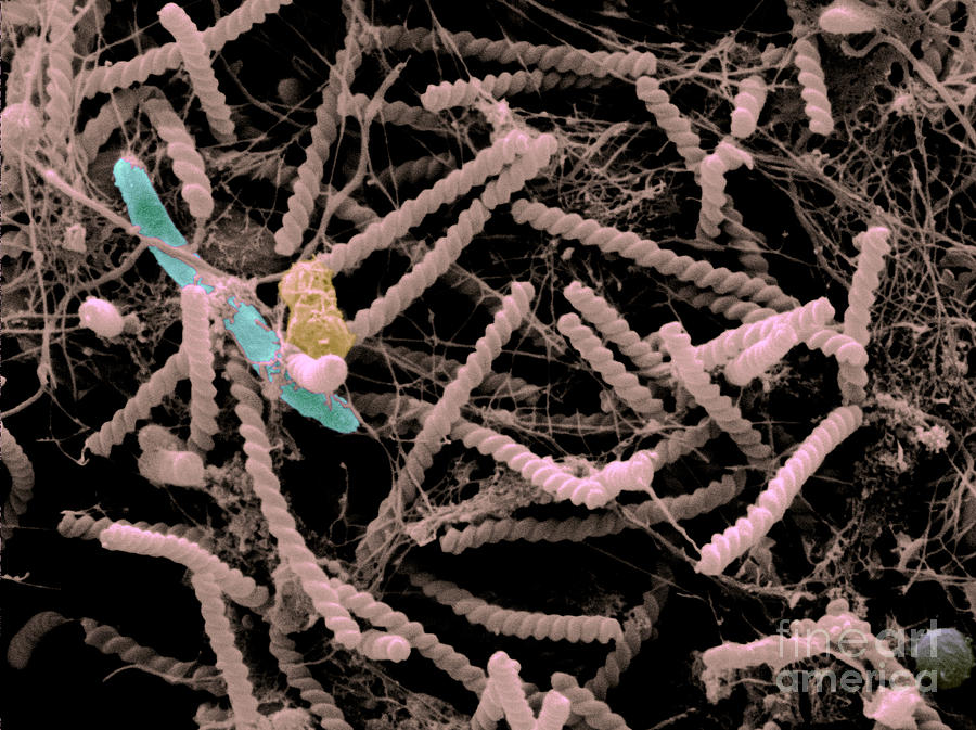 Spirochaetes From A Drinking Cup Sem #5 Photograph by Scimat