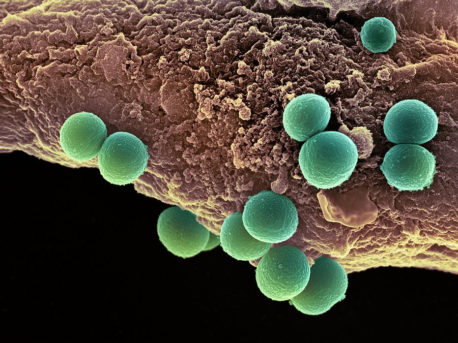 Staphylococcus Aureus Photograph - Staphylococcus Aureus Bacteria, Sem #5 by 