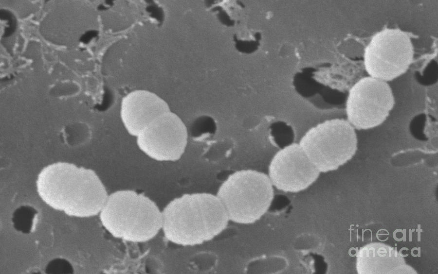 Streptococcus Cremoris #5 Photograph by Scimat
