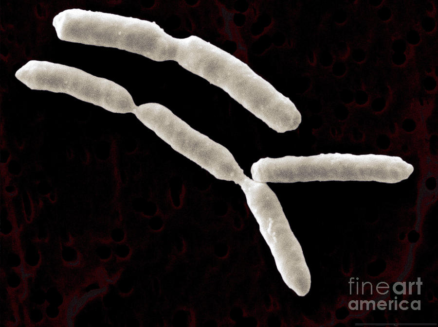 Yersinia Enterocolitica Bacteria #5 Photograph by Scimat