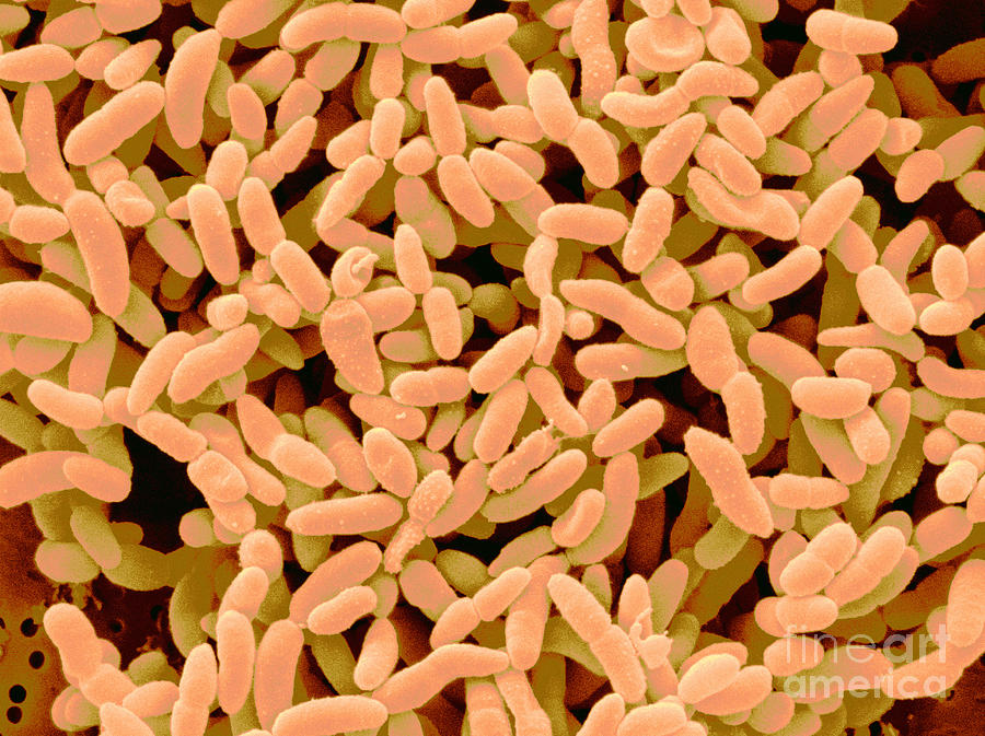 Acetobacter Aceti Bacteria #6 Photograph by Scimat