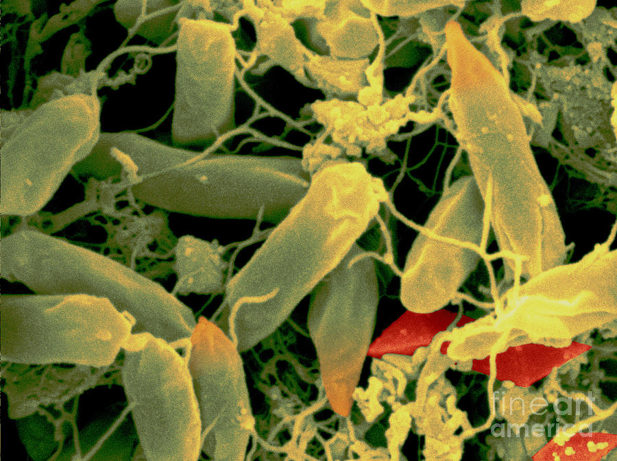 Bacillus Thuringiensis Bacteria #6 Photograph by Scimat