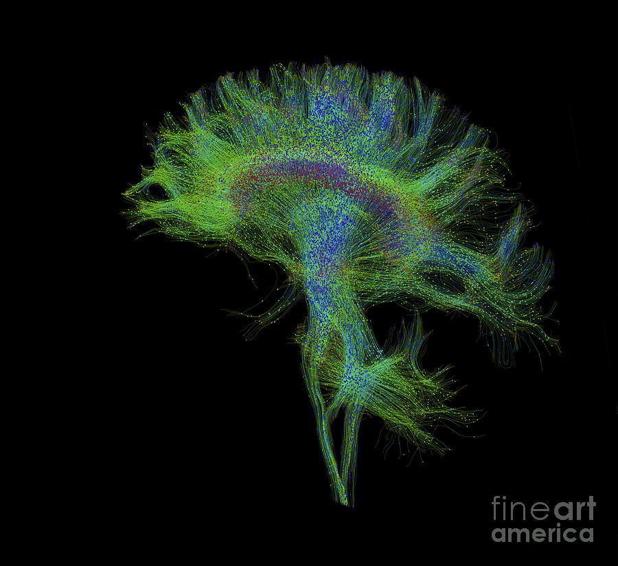 Brain, Fiber Tractography Image #6 Photograph by Scott Camazine