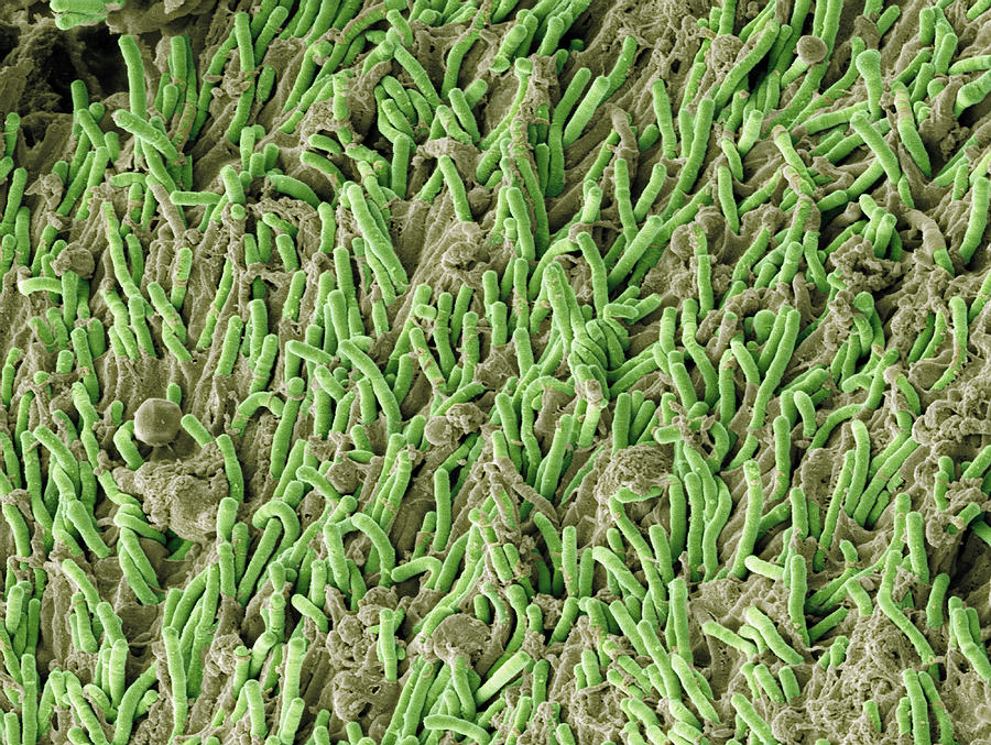 Fusobacterium Photograph - Dental Plaque, Sem #6 by Steve Gschmeissner
