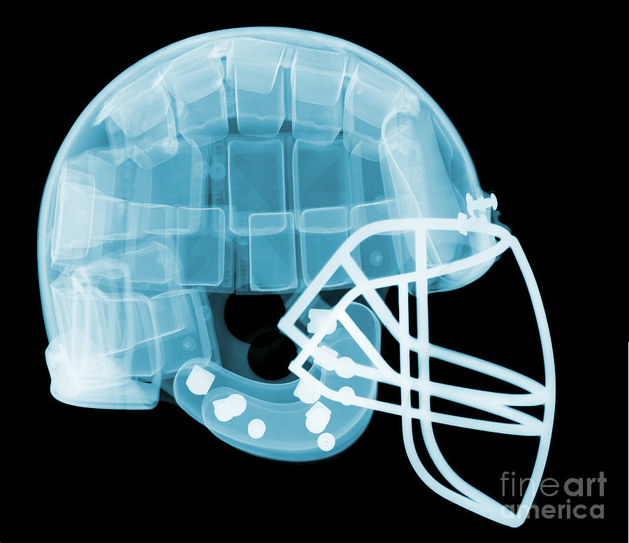Football Helmet X-ray #6 Photograph by Ted Kinsman