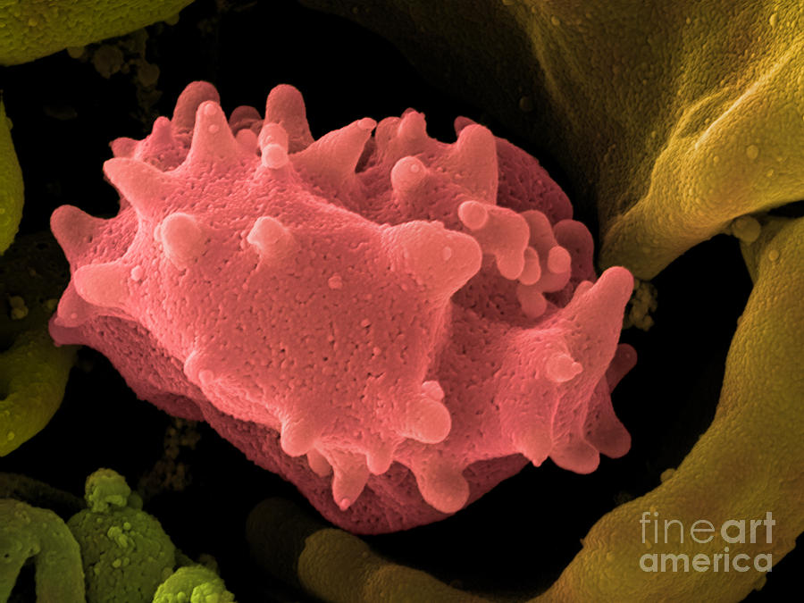 Human Lymphocyte Cell, Sem #6 Photograph by Ted Kinsman