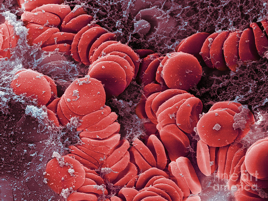 Human Red Blood Cells, Sem #6 Photograph by Ted Kinsman