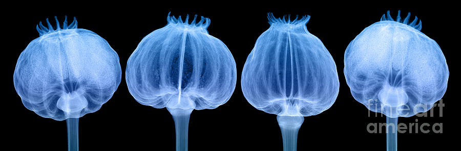 Opium Poppy Pods, X-ray #6 Photograph by Ted Kinsman