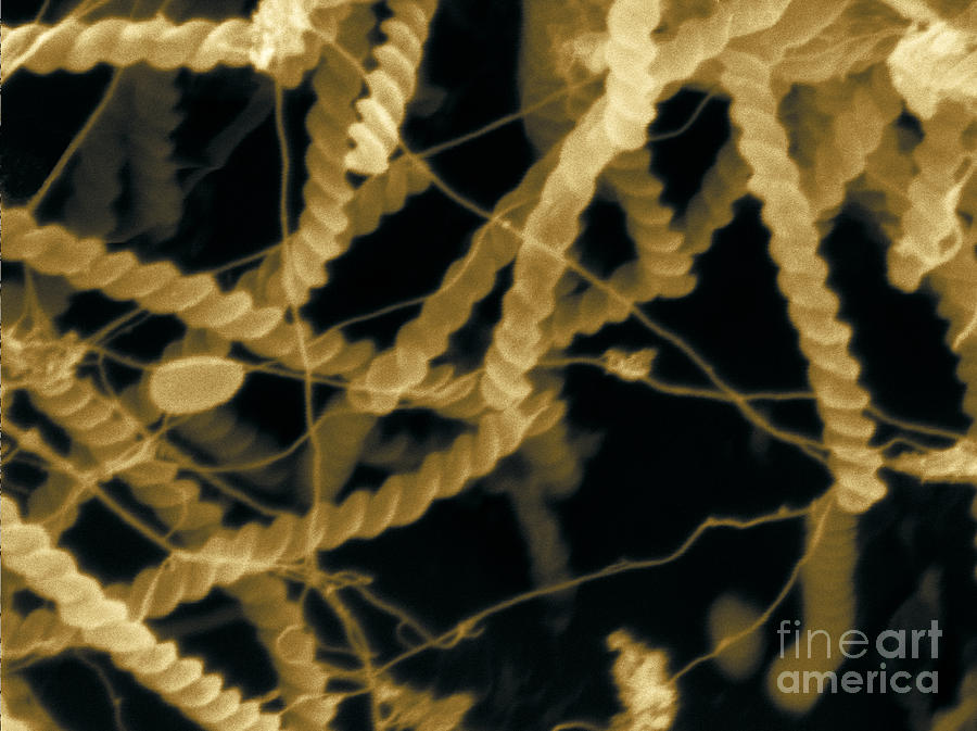 Spirochaetes From A Drinking Cup Sem #6 Photograph by Scimat