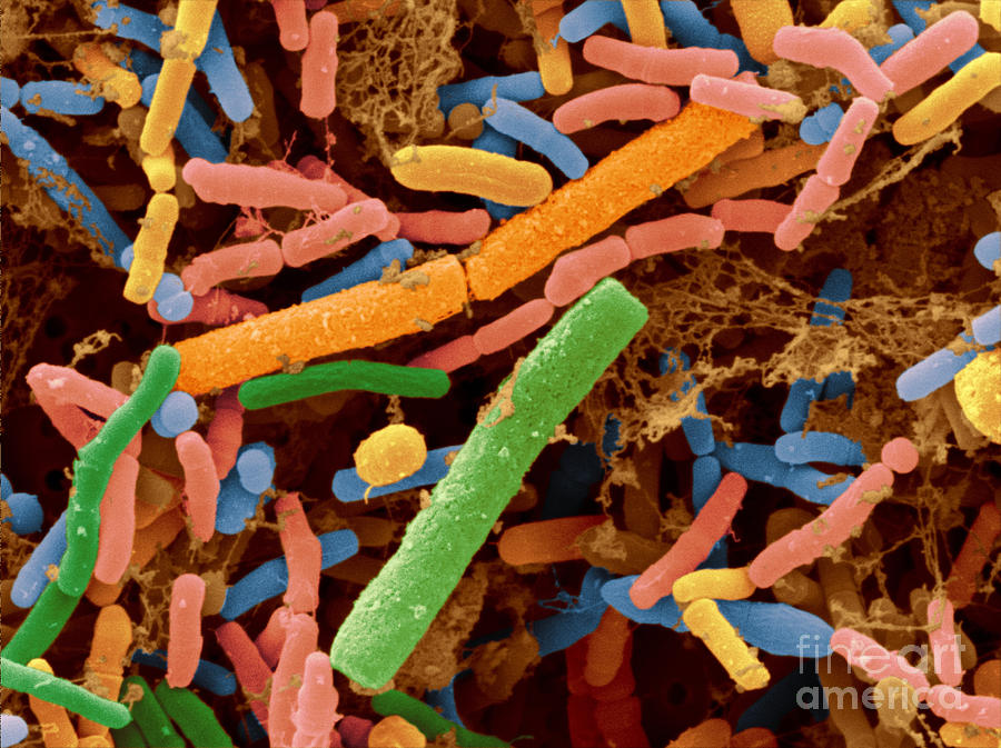Toddlers Feces With Bifidobacteria, Sem #6 Photograph by Scimat