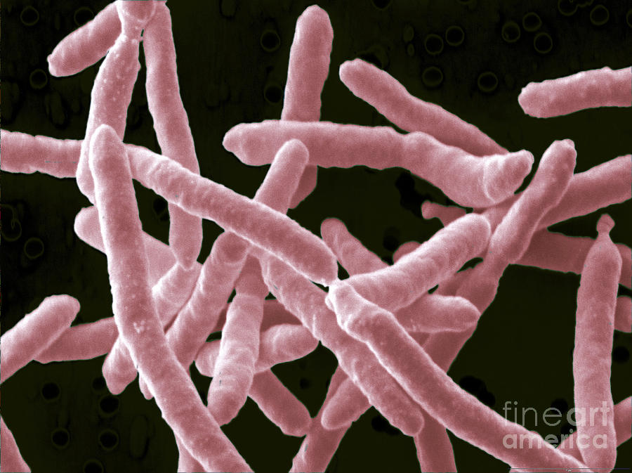 Yersinia Enterocolitica Bacteria #6 Photograph by Scimat