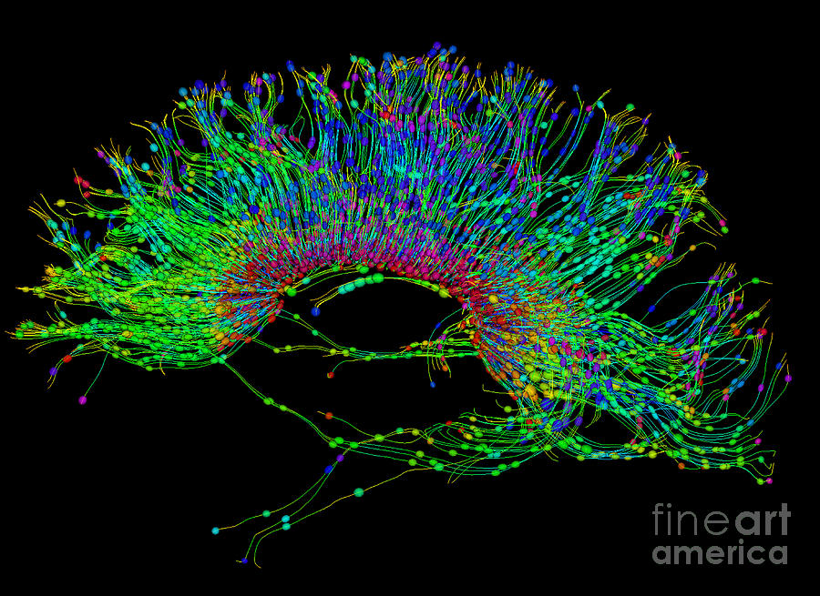Brain, Fiber Tractography Image #7 Photograph by Scott Camazine